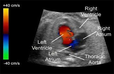12024201-5bae-4cff-b65f-444569c57807